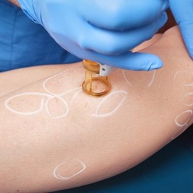 Tratamientos: Kristene Paul